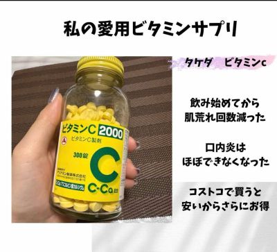 Viên uống bổ sung Vitamin C Takeda 2000mg